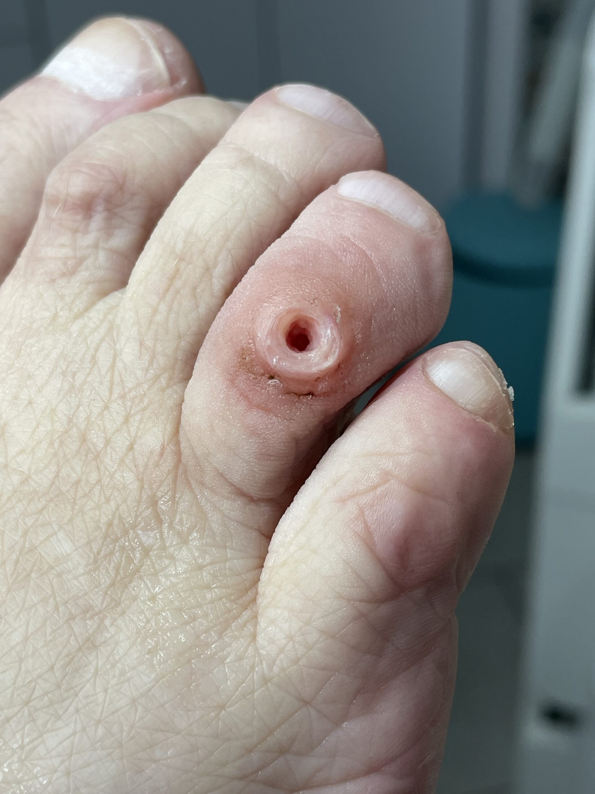 usuniAcie odcisku po scaled